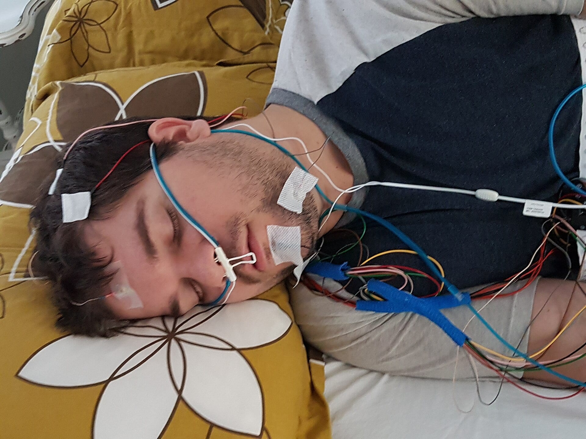 A man asleep on his side wearing sensors on his face and head for a sleep study